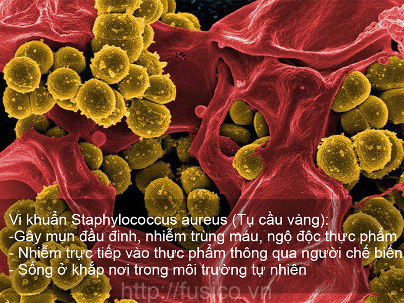 Vi khuẩn Staphylococcus aureus - Tụ cầu vàng