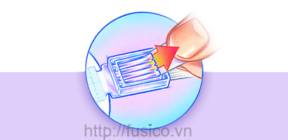 điều chỉnh dây đai