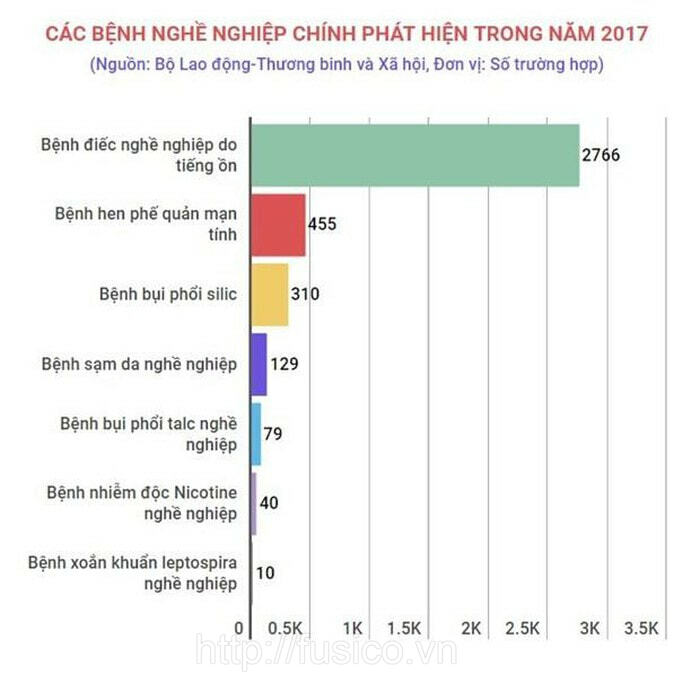 Thống kê bệnh điếc nghề nghiệp năm 2017